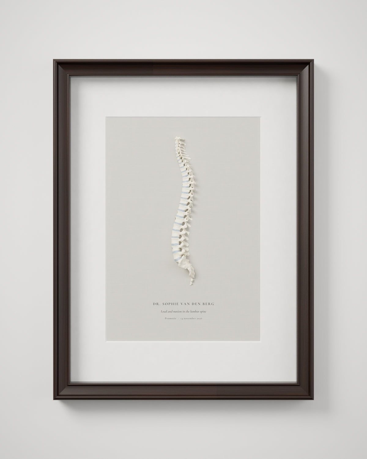 Ingelijst anatomisch model van de wervelkolom op een print, in een donkere houten lijst